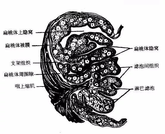 扁桃体隐窝里面是黑色图片