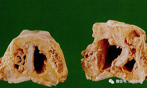 動物疫病豬傳染性萎縮性鼻炎swineinfectiousatrophicrhinitis