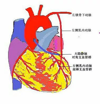 死亡冠血管位置图片