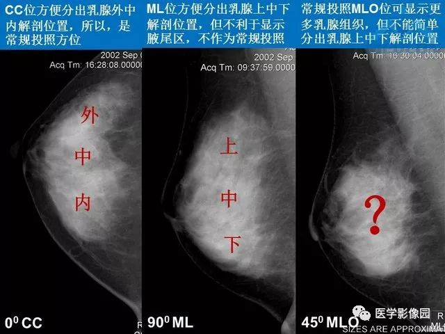 乳腺内外斜位图片