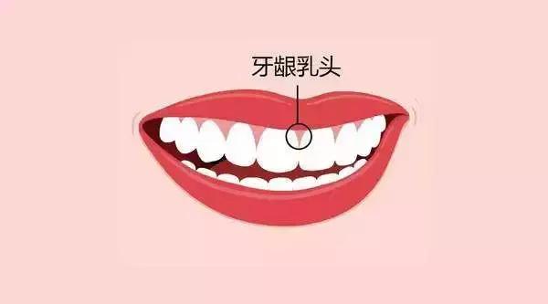 最主要有以下几个 生理性牙龈萎缩 随着年龄增长 牙龈乳头高度每年