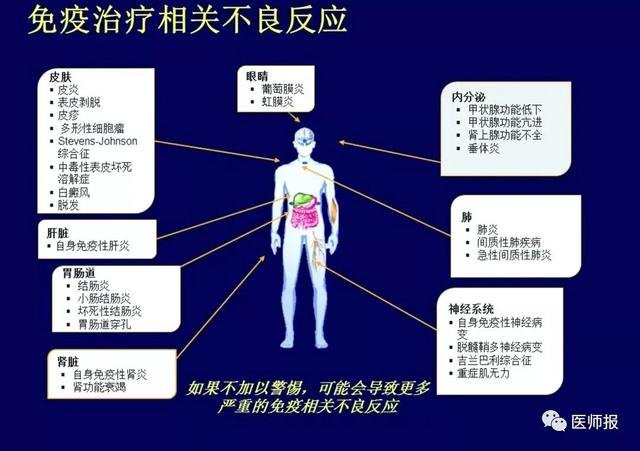 免疫治療相關的不良反應不容忽視