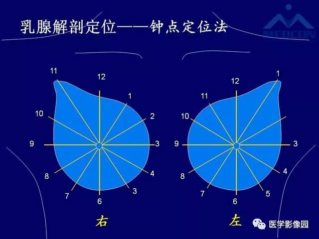 左乳腺2点钟位置图图片