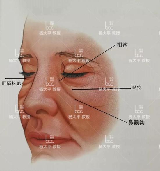 人脸上的8个窝图片