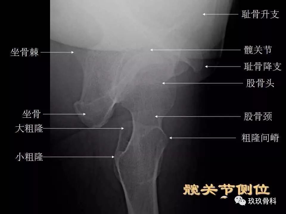 骨盆x线解剖图片