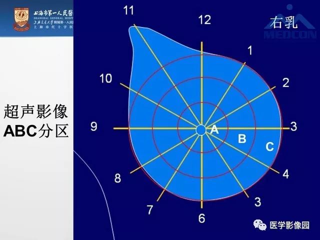 专家手把手教您x线摄影如何对乳腺病灶精确定位影像天地