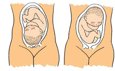 孕周与肚脐位置示意图图片