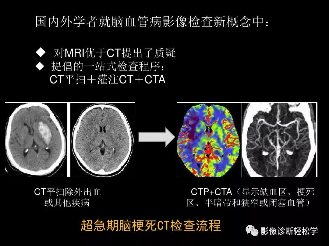 ct灌注成像图像解读图片