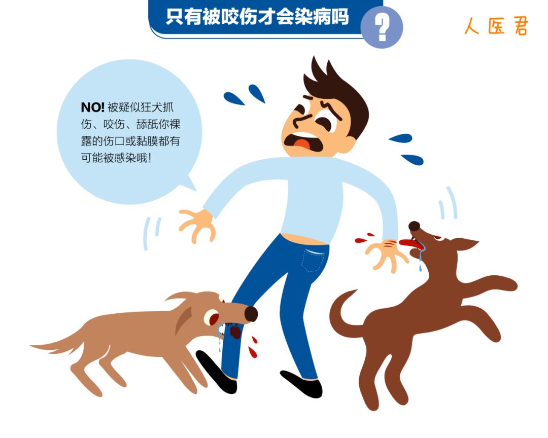 狂犬病毒卡通图片