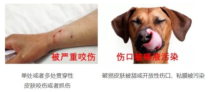 你想知道的狂犬病知識在這裡_傷口