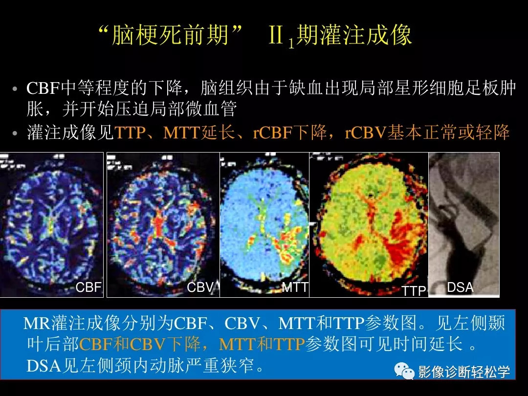 ct灌注成像图像解读图片