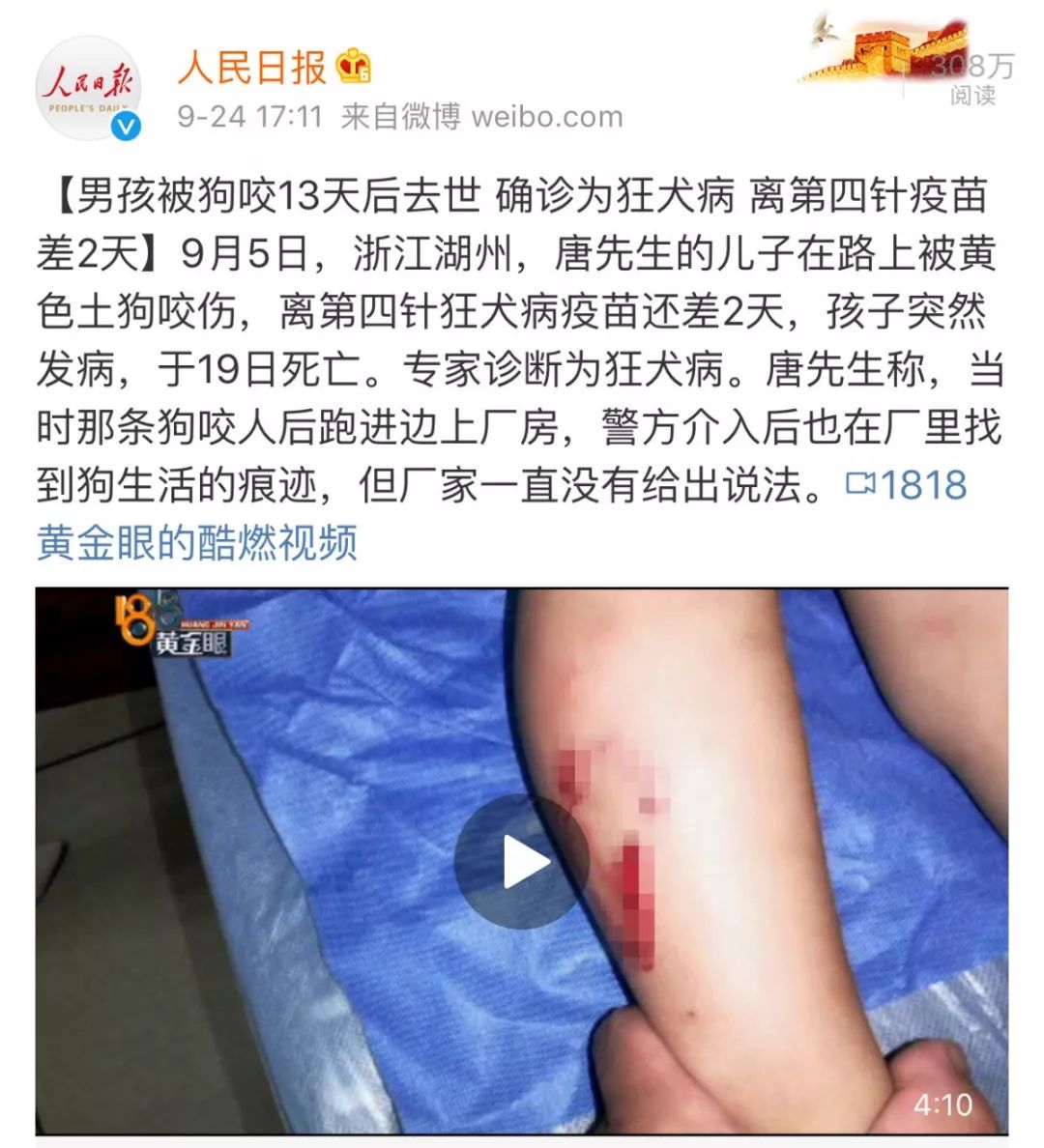 福州男童被自家狗撕咬,三道伤口触目惊心…小可爱可能也是小恶魔!