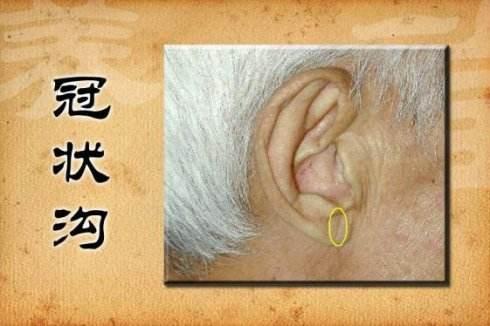 耳褶心征 科学依据图片