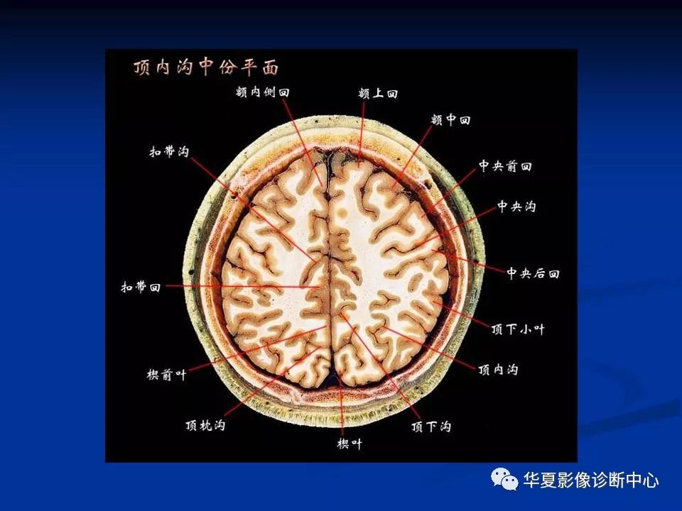 影像回顧頭顱基本斷層解剖