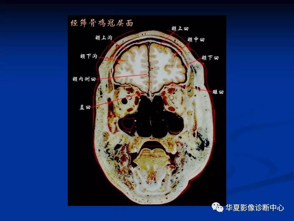 影像回顧頭顱基本斷層解剖