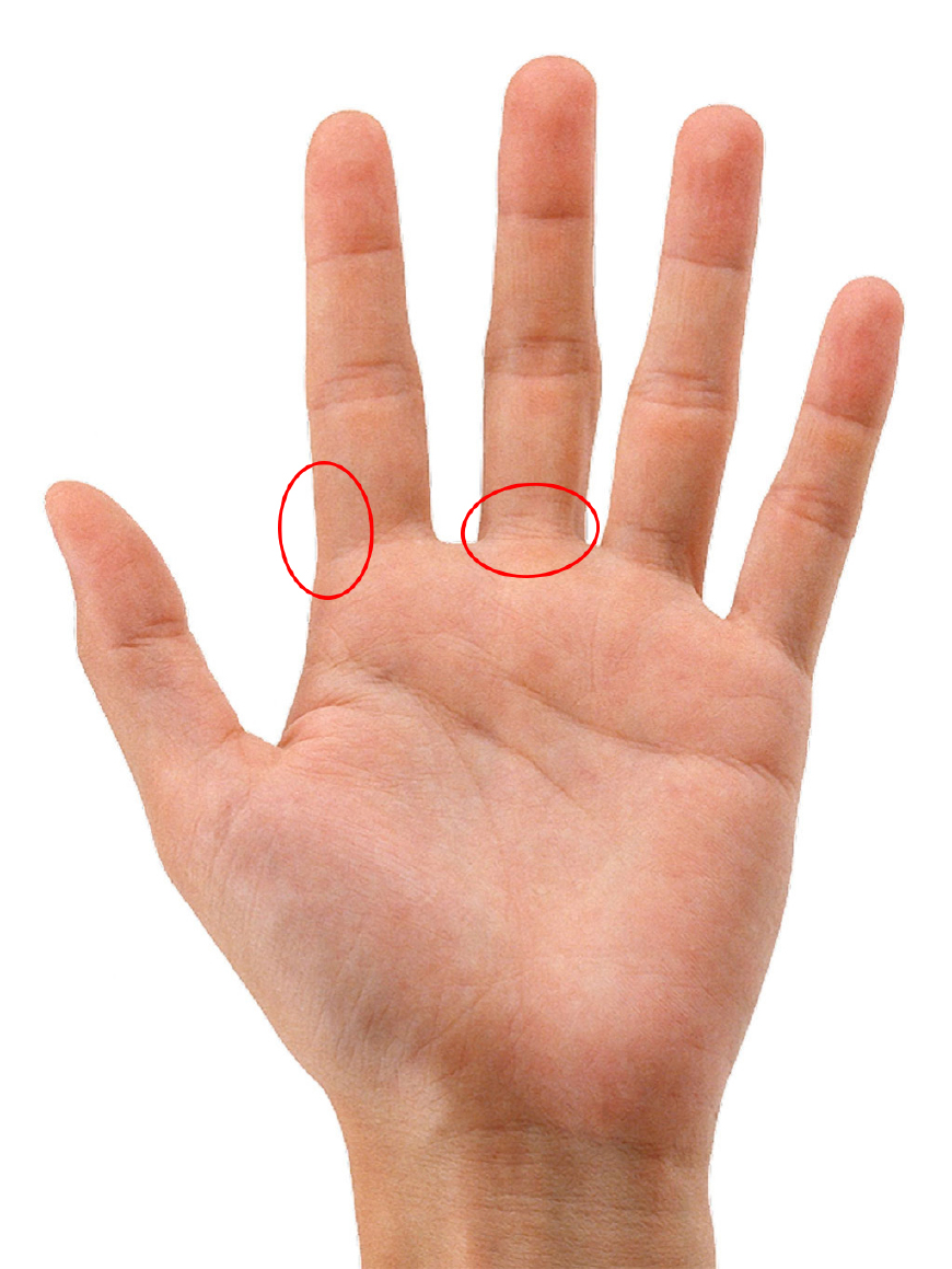 若小指外侧有明显青筋,则大多从小肾气不足,容易腰膝酸软,浑身乏力
