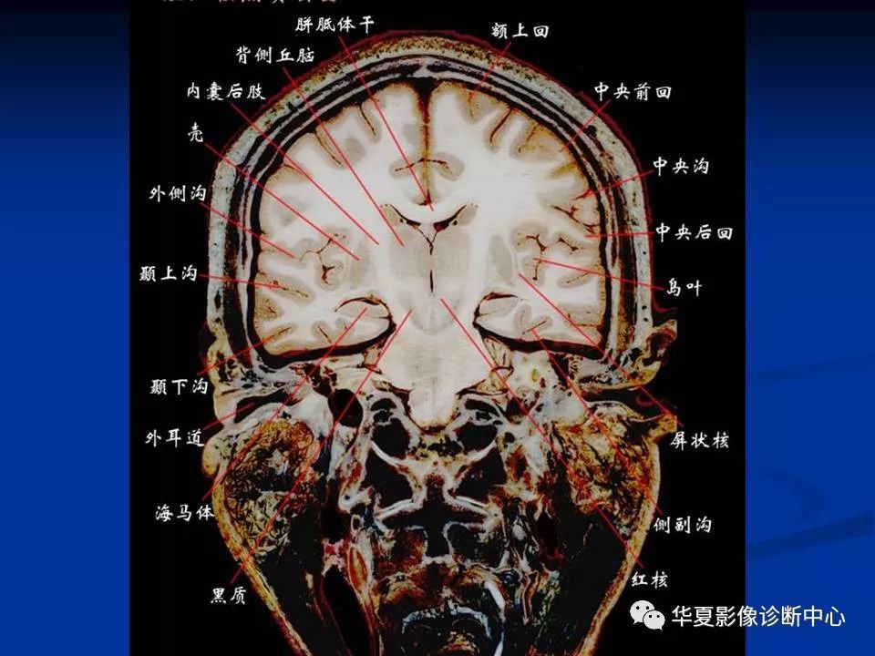 面颅骨CT解剖图片