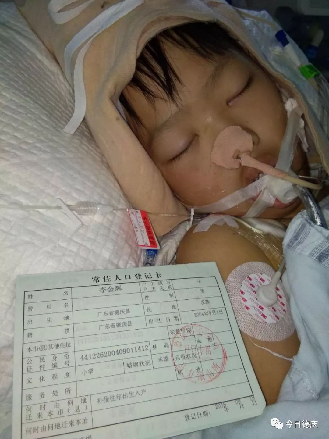 帮帮他 马圩年仅14岁少年脑水肿被送进icu