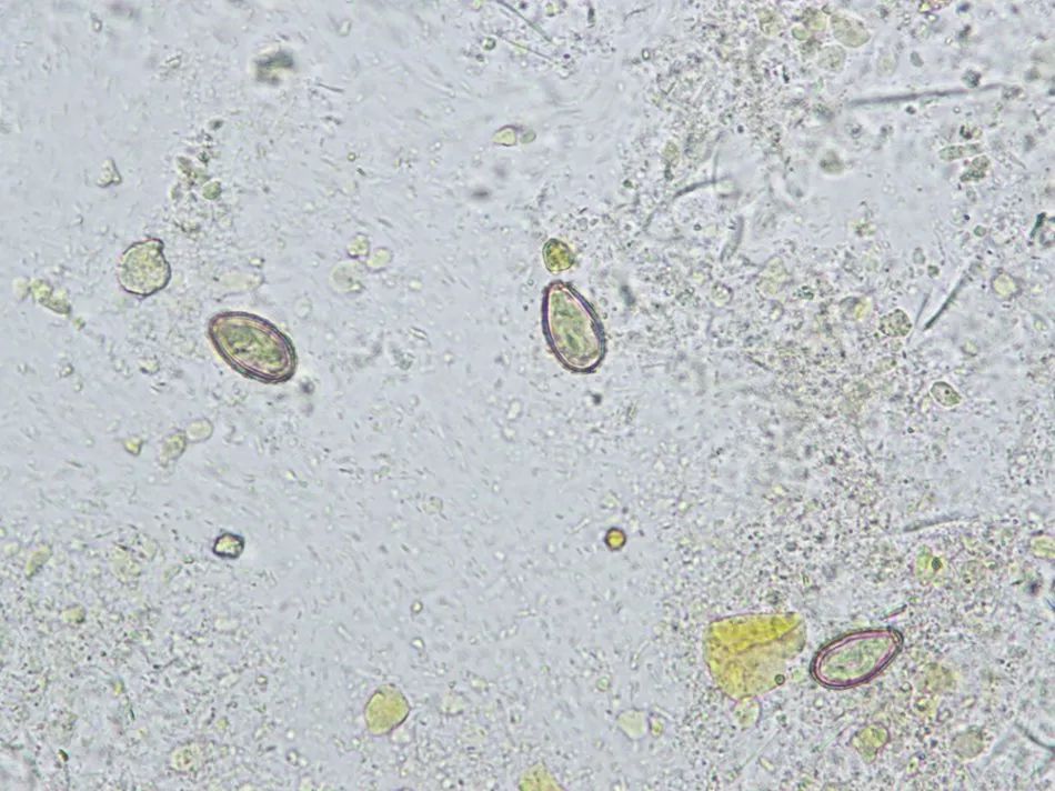 肝吸虫虫卵图片图片