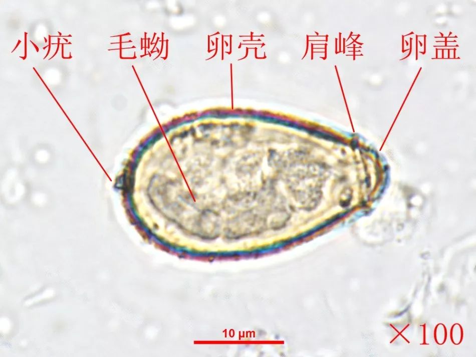 肝吸虫卵形态特点是这样的:虫卵形似芝麻粒,黄褐色,个体较小,长度约为