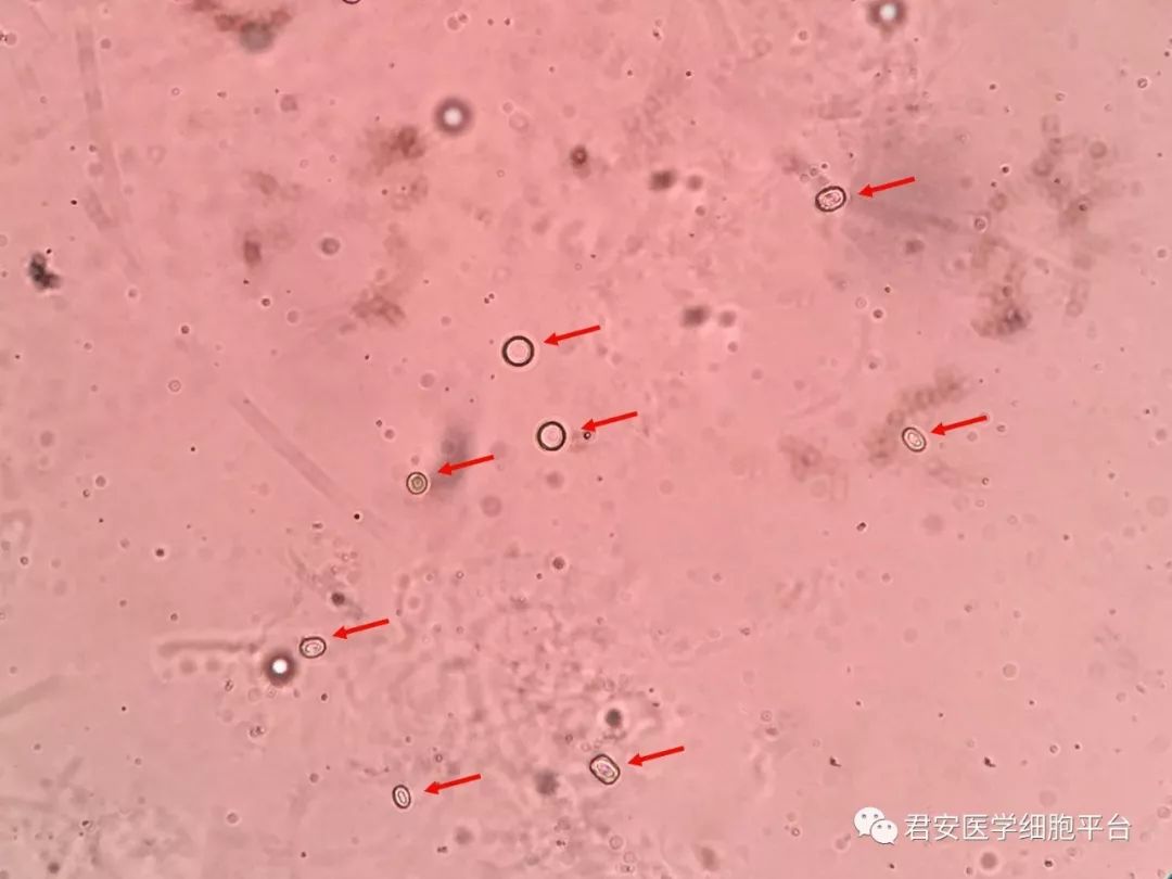 草酸钙簇晶显微图片图片