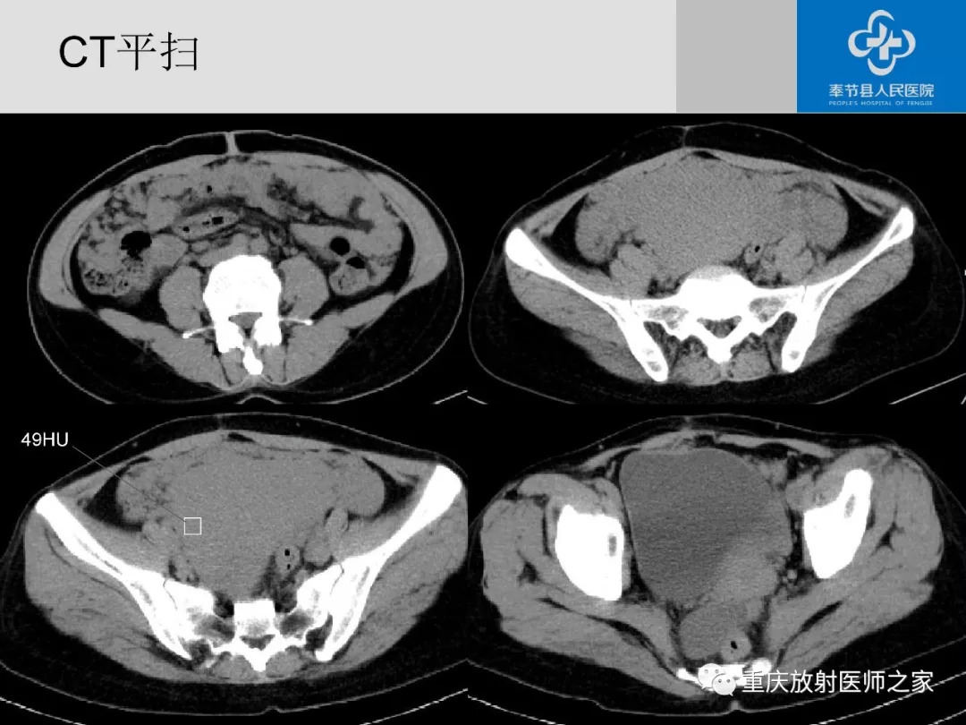 頭頸部,胸,心,腹,盆腔五大部位可以放在口袋裡的ct/mri解剖圖解點擊