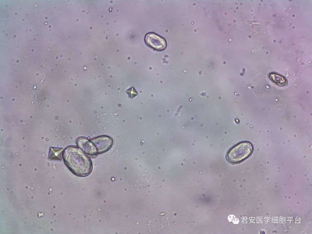 我可以方也可以圆但我还是我形态多变的草酸钙结晶