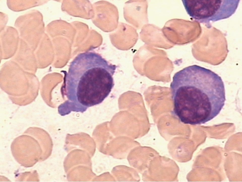 浆细胞胞体图片