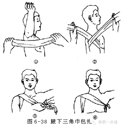 急救止血包扎