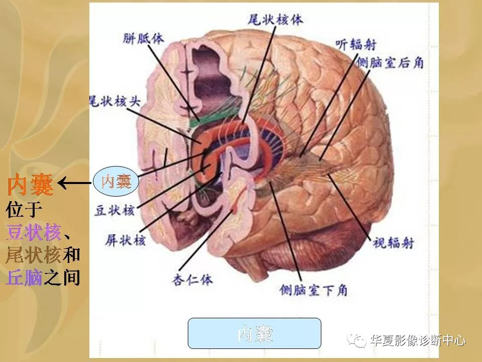 基底节区解剖位置关系图