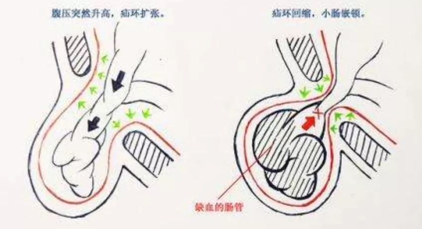 外科手術分類