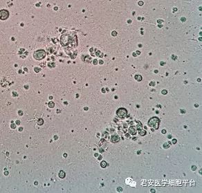 前列腺粒细胞吞噬大量细菌图2神经内分泌细胞?图3