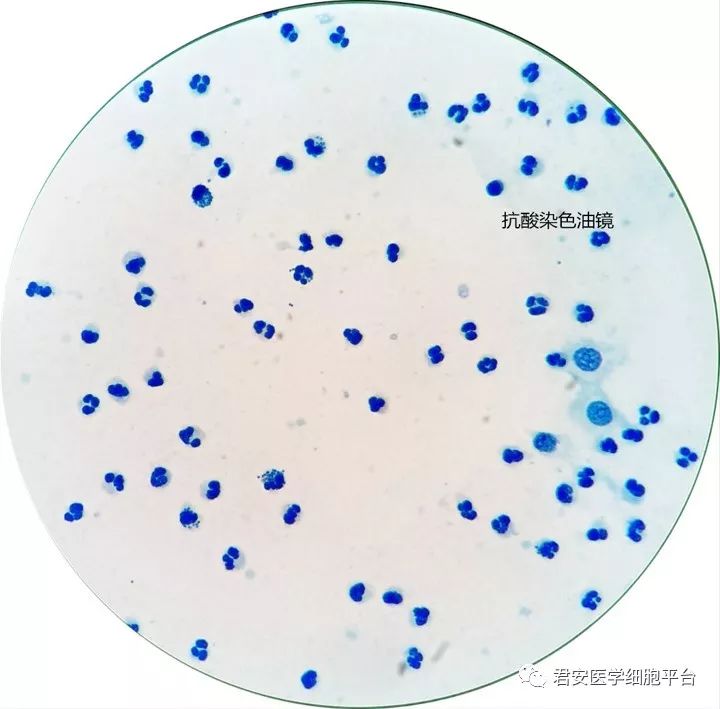 前列腺颗粒细胞图片