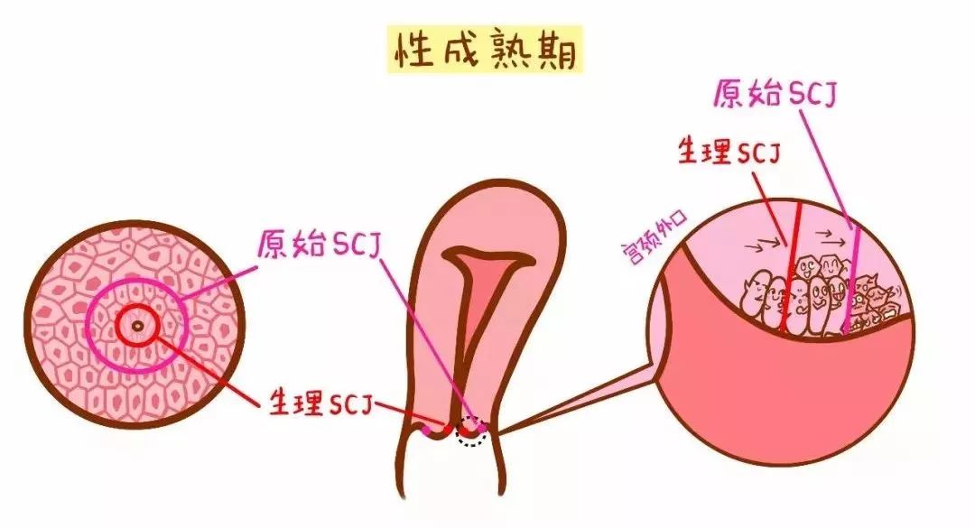 宫颈内口和外口图片