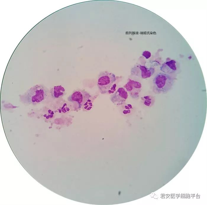 前列腺颗粒细胞图片