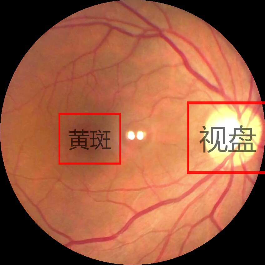 泰立瑞数字眼底镜为您解密眼底乾坤