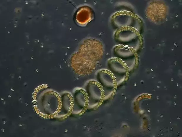 10种水中常见的细菌在显微镜下的样子你真的不在意吗