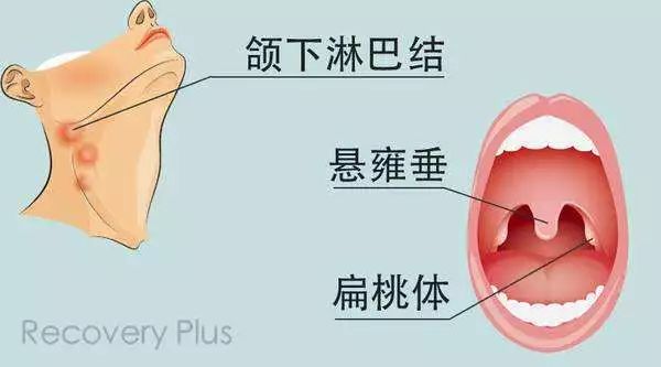 上颚淋巴结位置图片图片