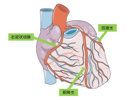 主动脉三个冠瓣示意图图片