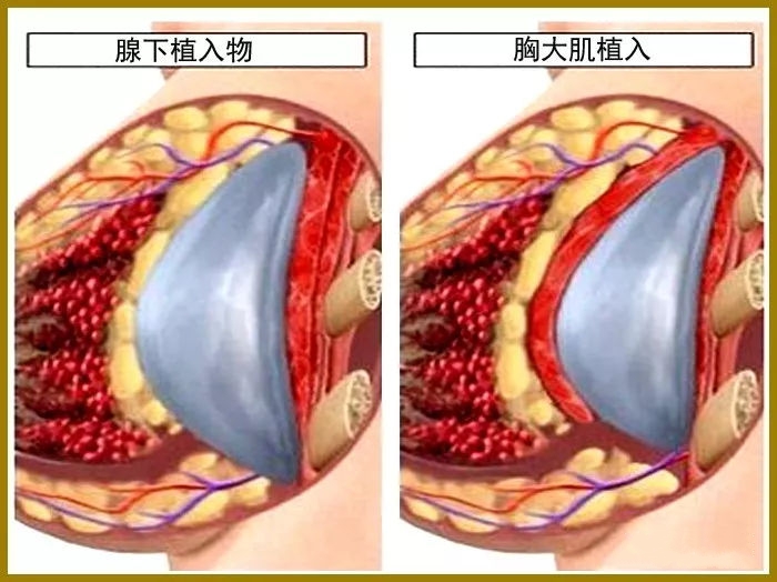 乳房上红色硬疙瘩图片图片