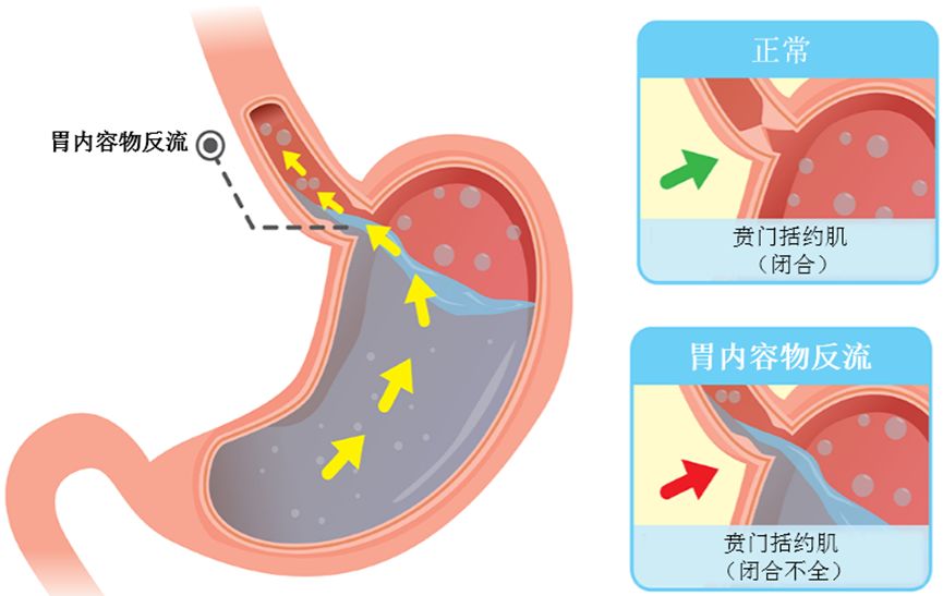 贲门是哪里图片