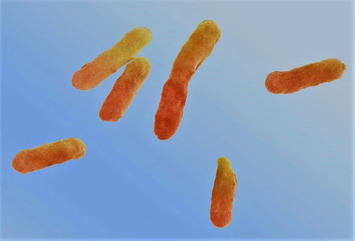 肉毒梭菌芽孢图片图片