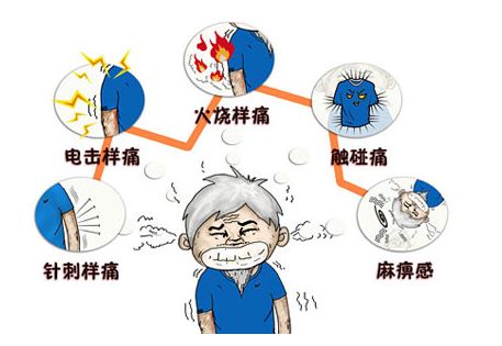 世界镇痛日:原来身体出现这些疼痛都要找疼痛科医生?