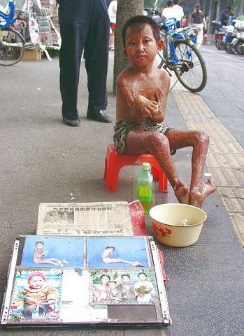 残疾儿童乞讨被拐卖图片