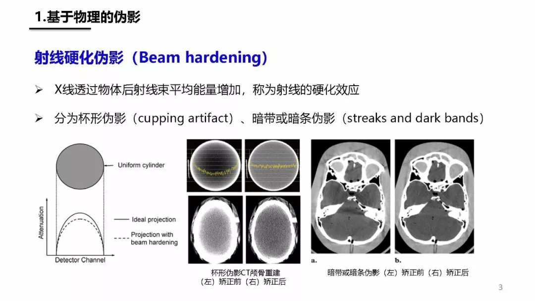 ct伪影产生机制及图像表现,您都清楚了吗?