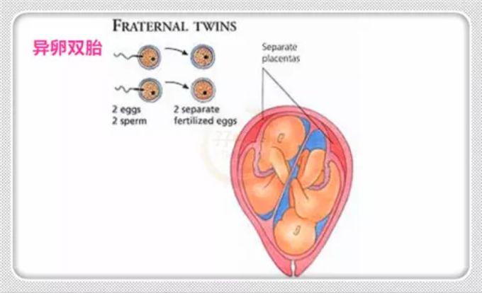 若发现其中一个有基因方面的疾病了,另一个几乎无一例外,而异卵双胞胎