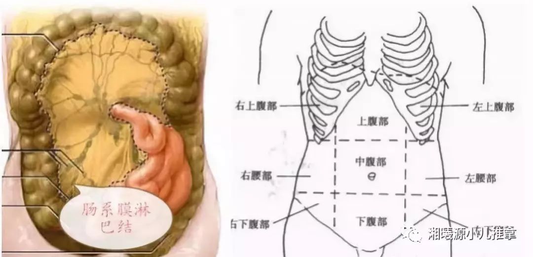 肠系膜淋巴结的位置图图片