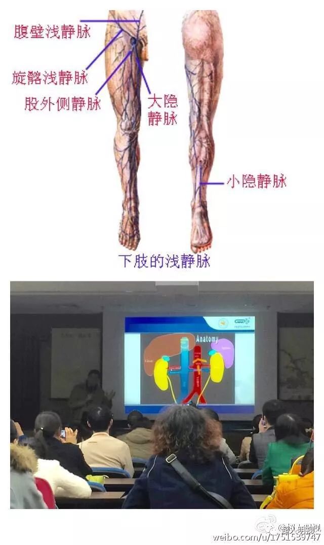 小隐静脉走行图片图片