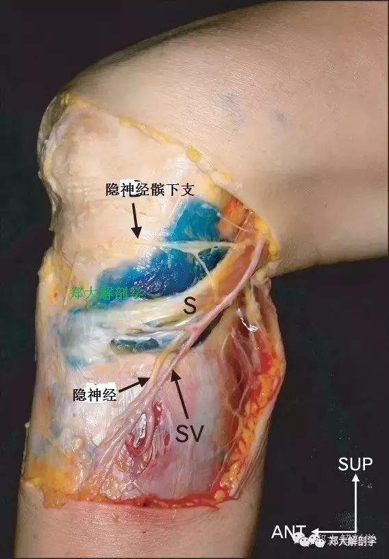 3 坐骨神經--脛神經腰椎和骨盆腰椎和骨盆功能紊亂後出現神經根卡壓