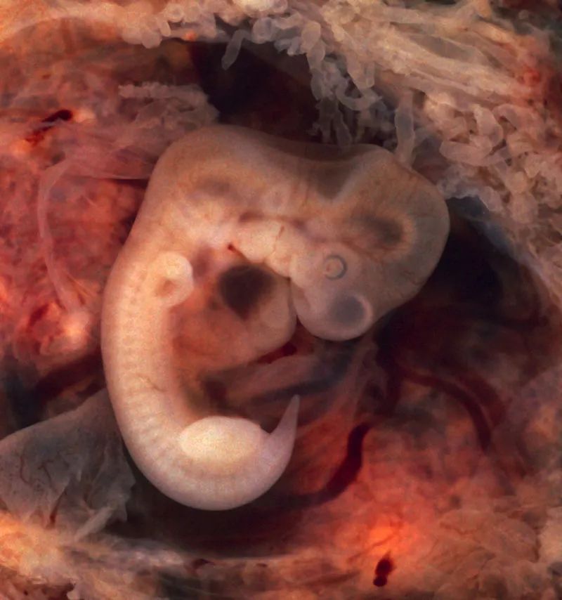 怀孕第七周的人类胚胎(图片来源:维基百科)